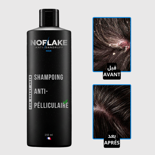 شامبو ضد القشرة للرجال